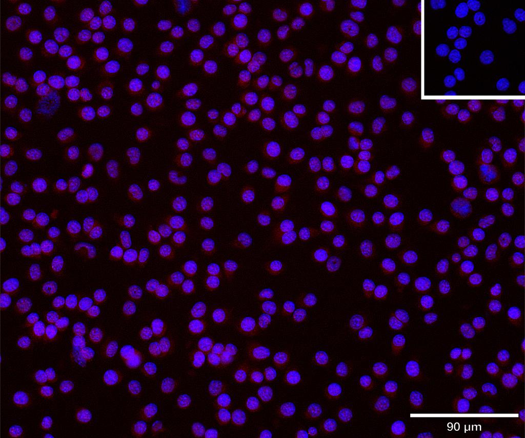 Ankyron KLF4_MOUSE Clone DV40785