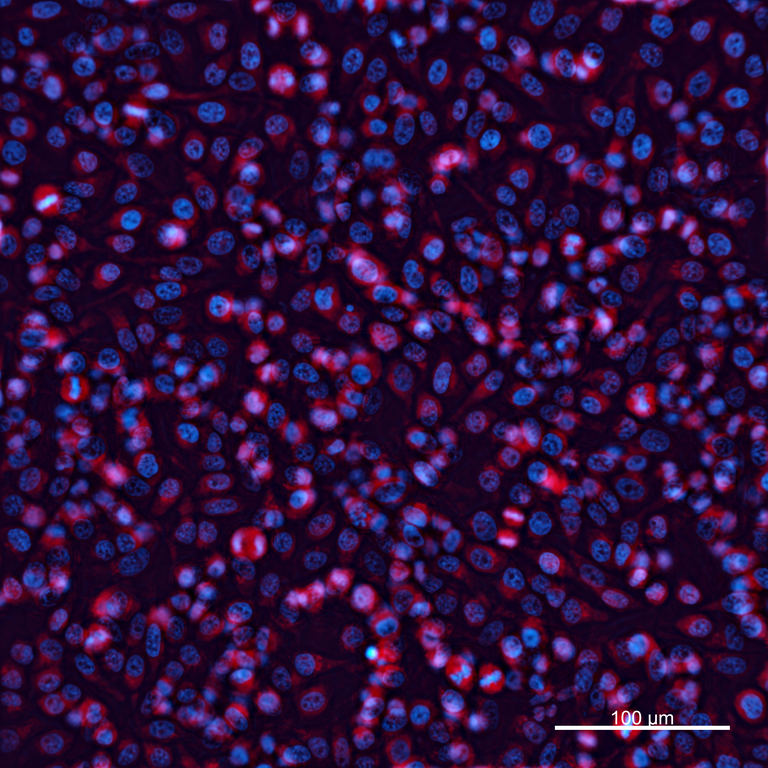 Ankyron LATS1_HUMAN Clone EV40119