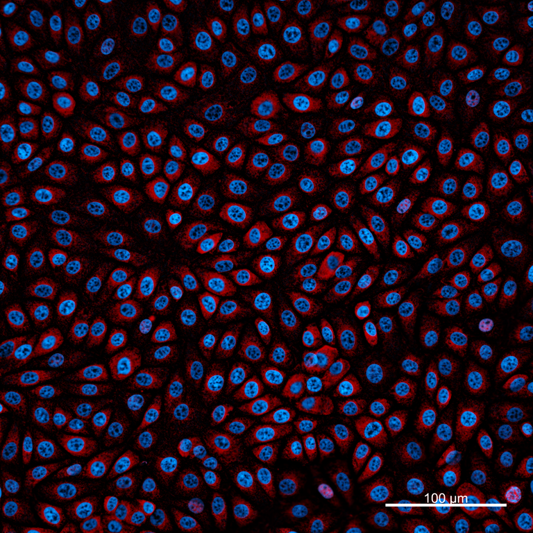 Ankyron LEG9_BOVIN Clone FA40810