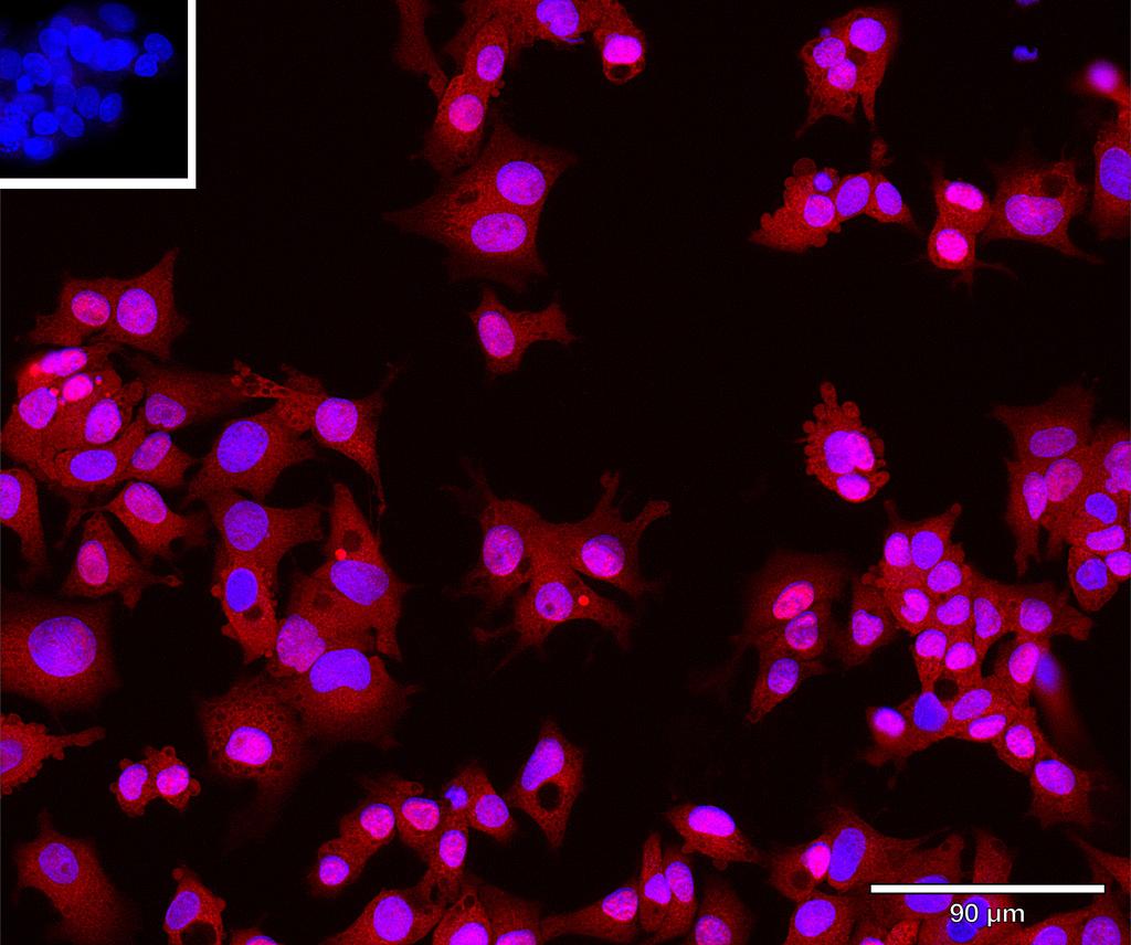 Ankyron LIPR1_HUMAN Clone AR40479
