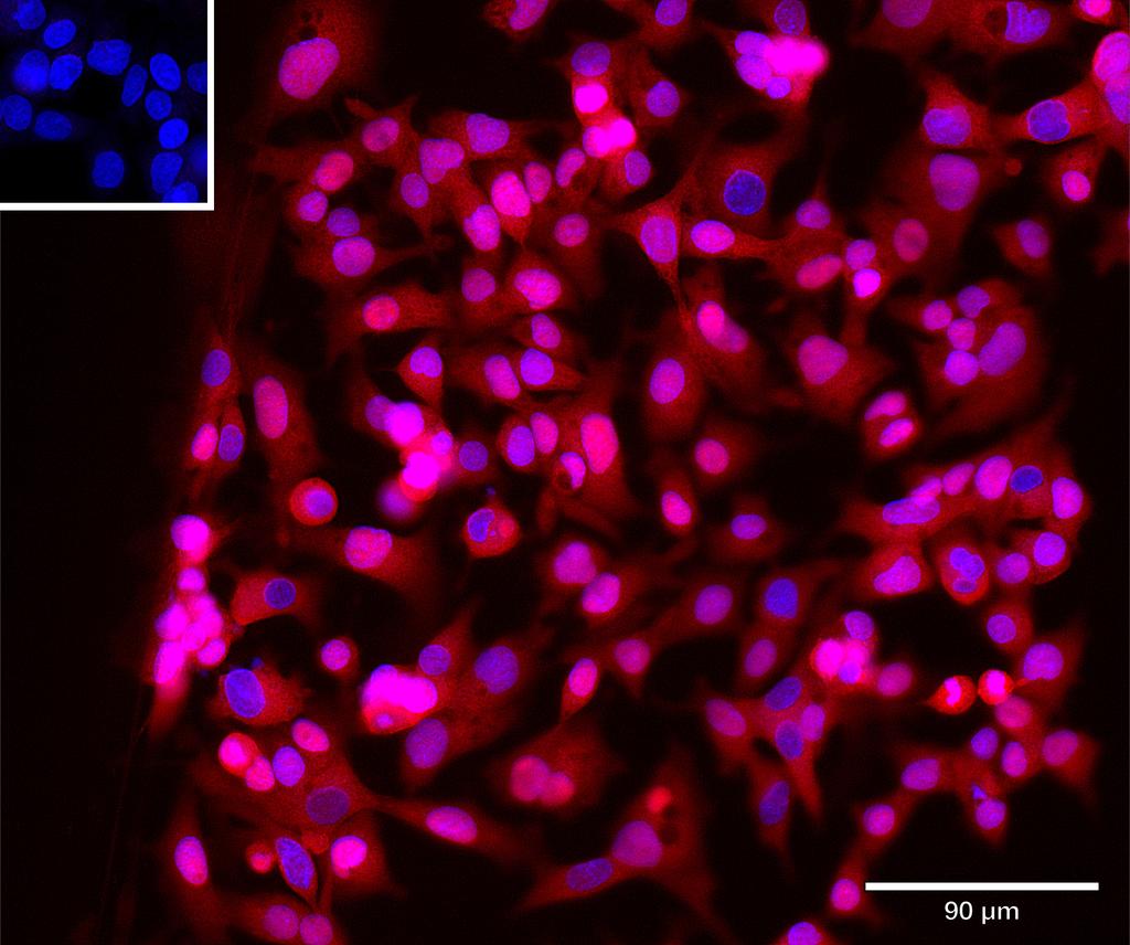 Ankyron LIPR1_HUMAN Clone AR40481