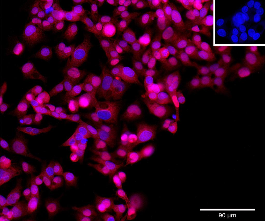 Ankyron LIPR1_HUMAN Clone AR40482