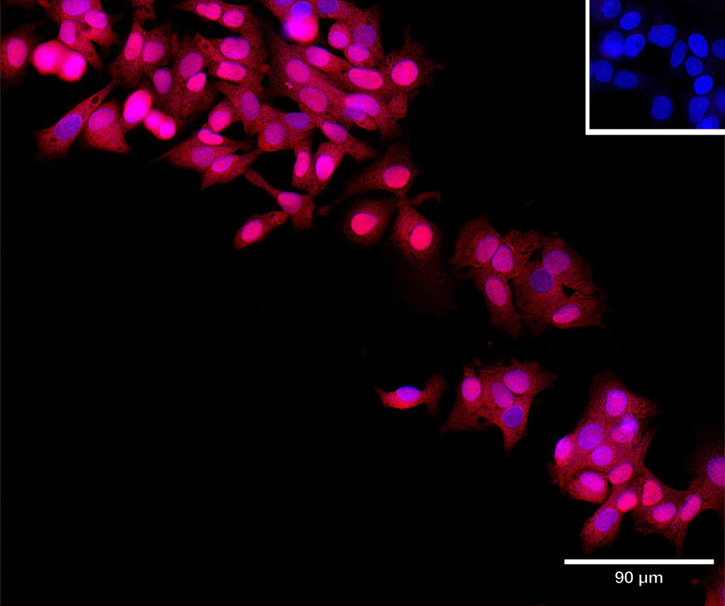 Ankyron LIPR1_HUMAN Clone AR40483
