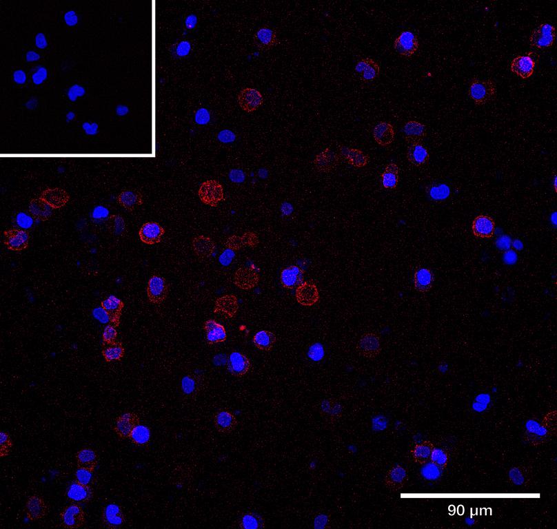 Ankyron LIRB2_HUMAN Clone BS40692