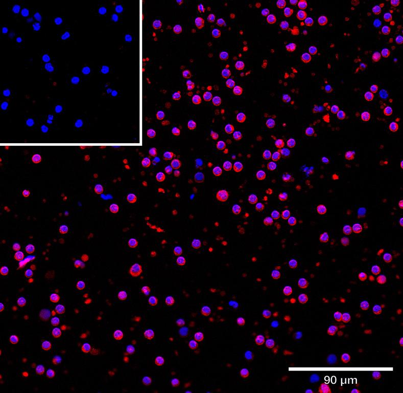 Ankyron LIRB5_HUMAN Clone AD40279