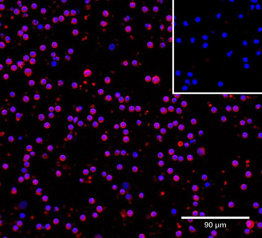 Ankyron LIRB5_HUMAN Clone AD40281