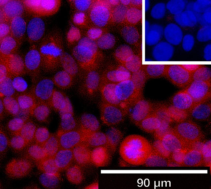 Ankyron LMCD1_HUMAN Clone CQ40207