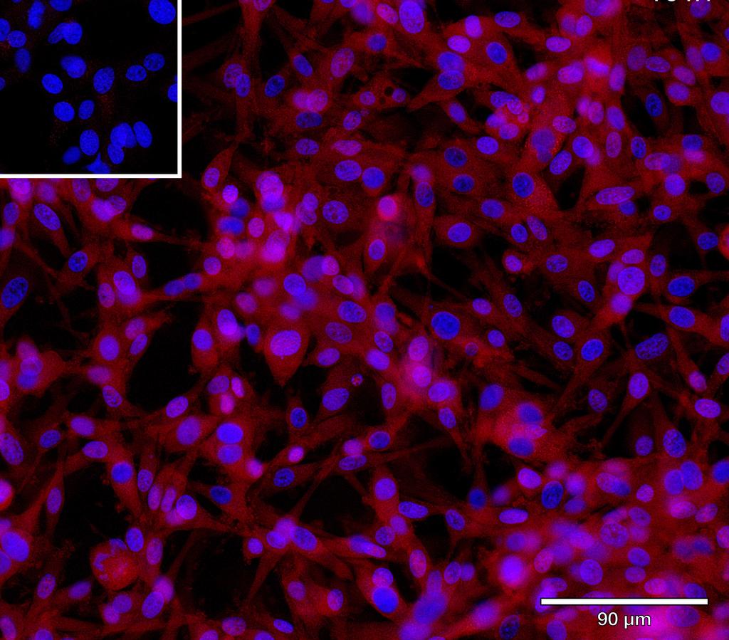Ankyron LRP10_HUMAN Clone CA30196