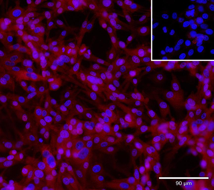 Ankyron LRP10_HUMAN Clone CA30203