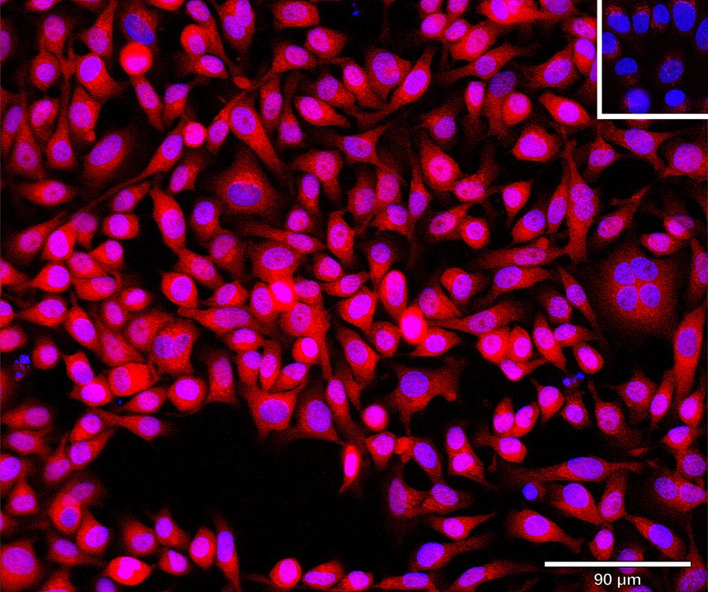 Ankyron LRP5_HUMAN Clone CO40227