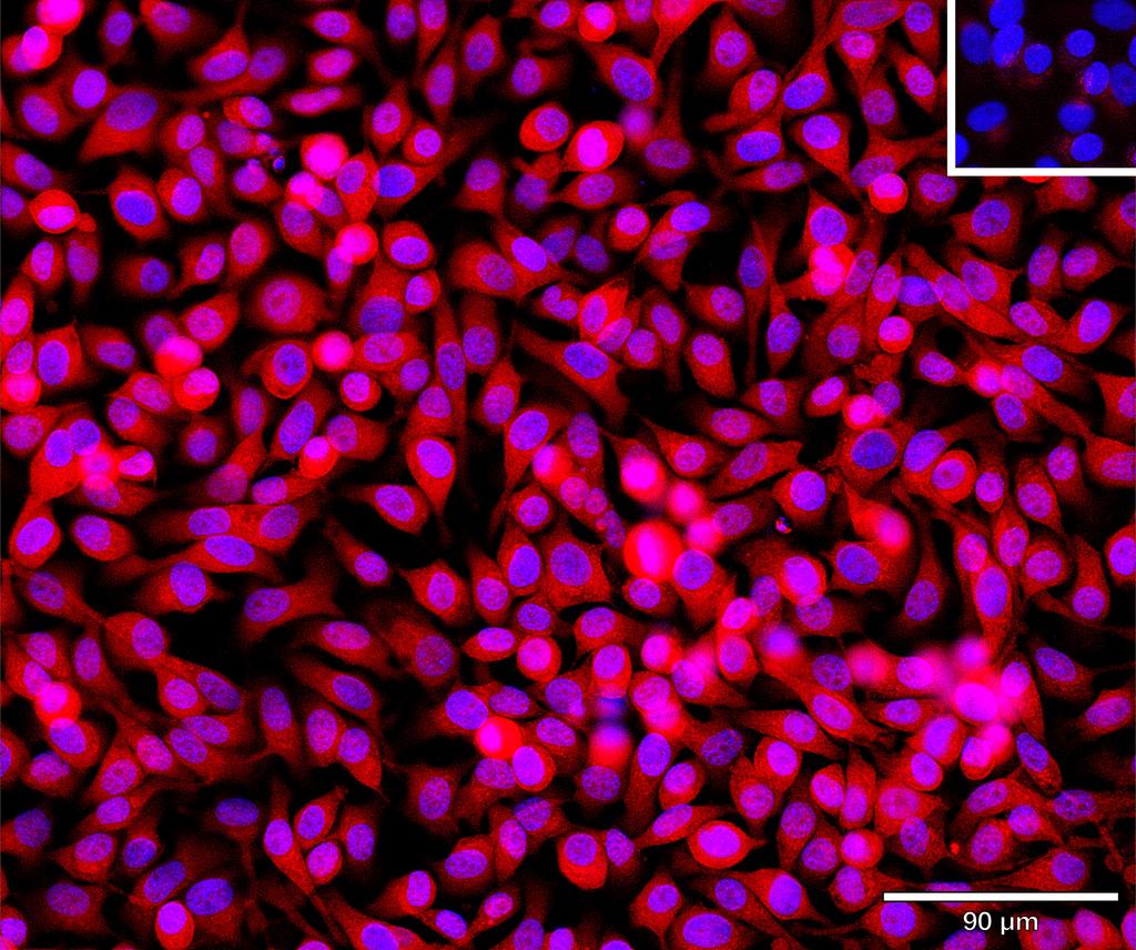Ankyron LRP5_HUMAN Clone CO40235