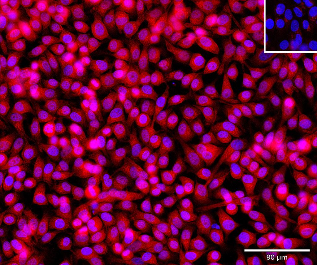 Ankyron LRP5_HUMAN Clone CO40242