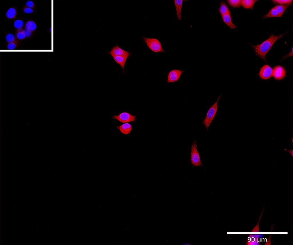 Ankyron LRP5_HUMAN Clone CO40248