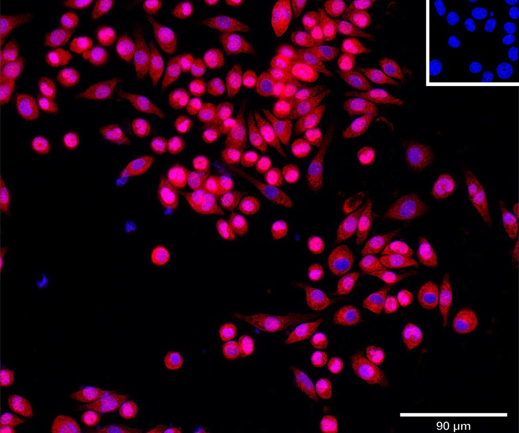 Ankyron LXN_MOUSE Clone BN30149