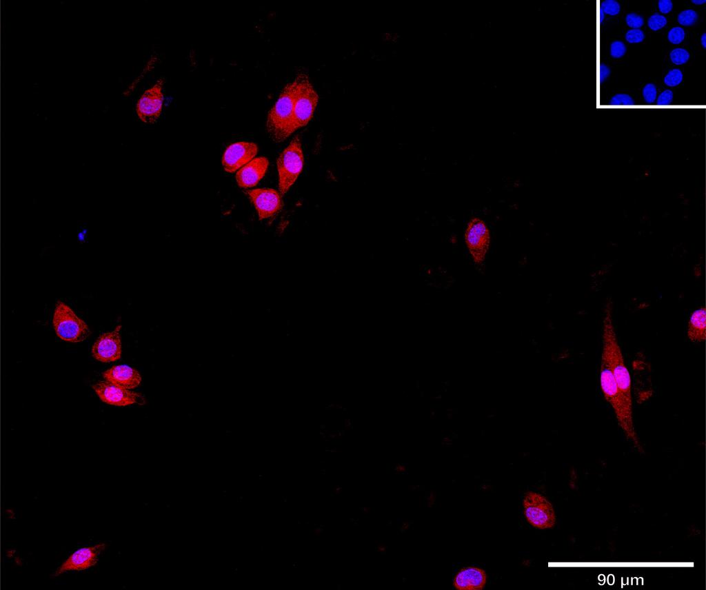 Ankyron LXN_MOUSE Clone BN30150