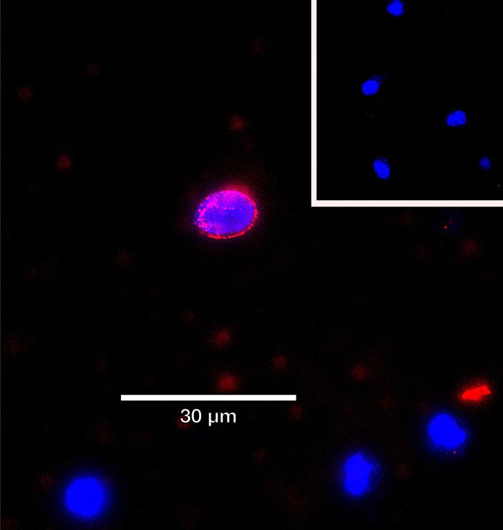 Ankyron LYAM1_HUMAN Clone AB40570