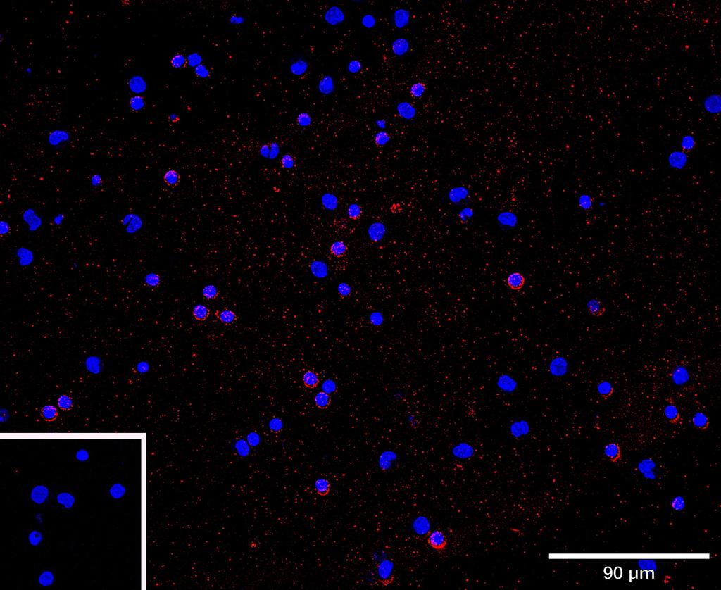 Ankyron LYAM1_HUMAN Clone AB30233