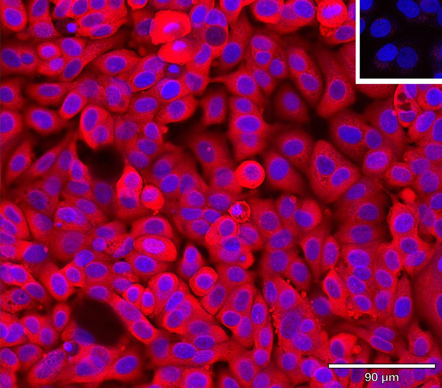 Ankyron LYPD3_HUMAN Clone AG40330