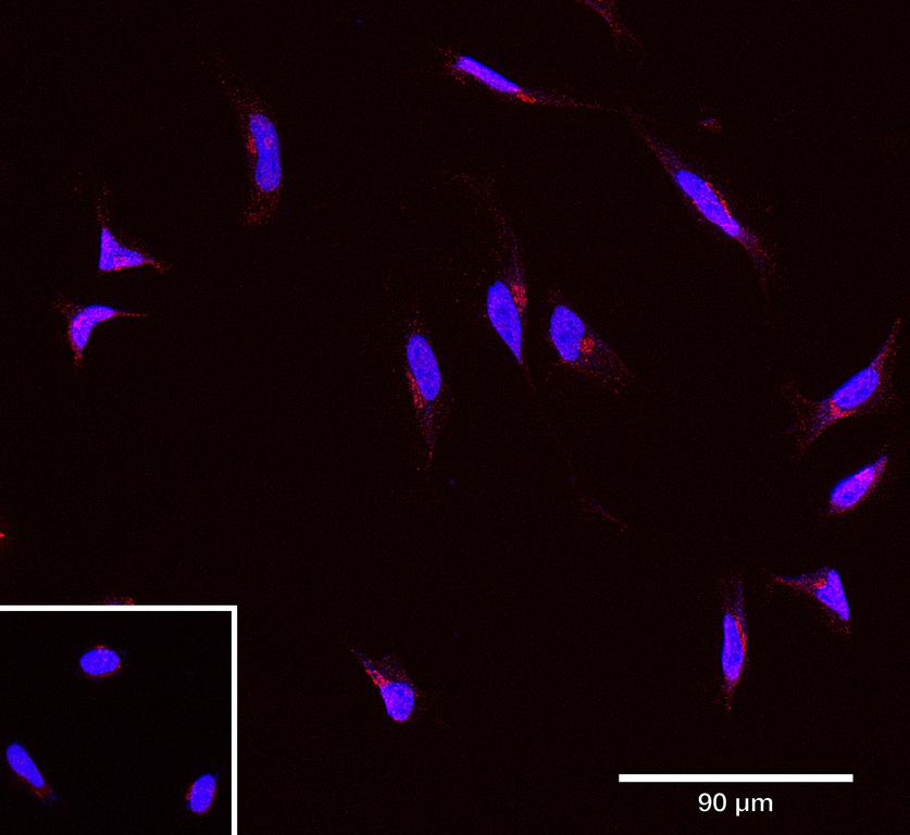 Ankyron MDM4_HUMAN Clone CL40512