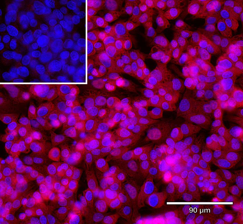 Ankyron MEP1B_HUMAN Clone AZ40850