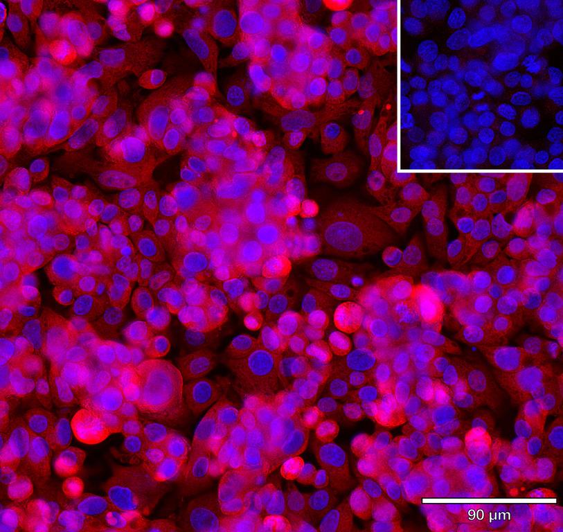 Ankyron MEP1B_HUMAN Clone AZ40853