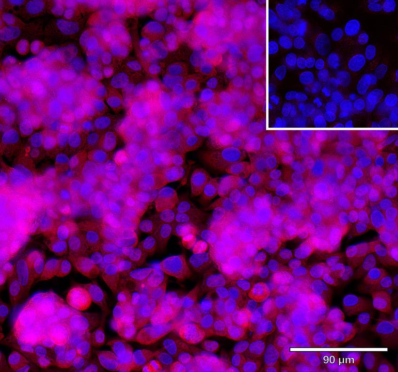 Ankyron MEP1B_HUMAN Clone AZ40854