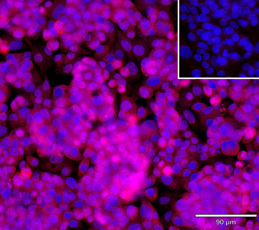 Ankyron MEP1B_HUMAN Clone AZ40855