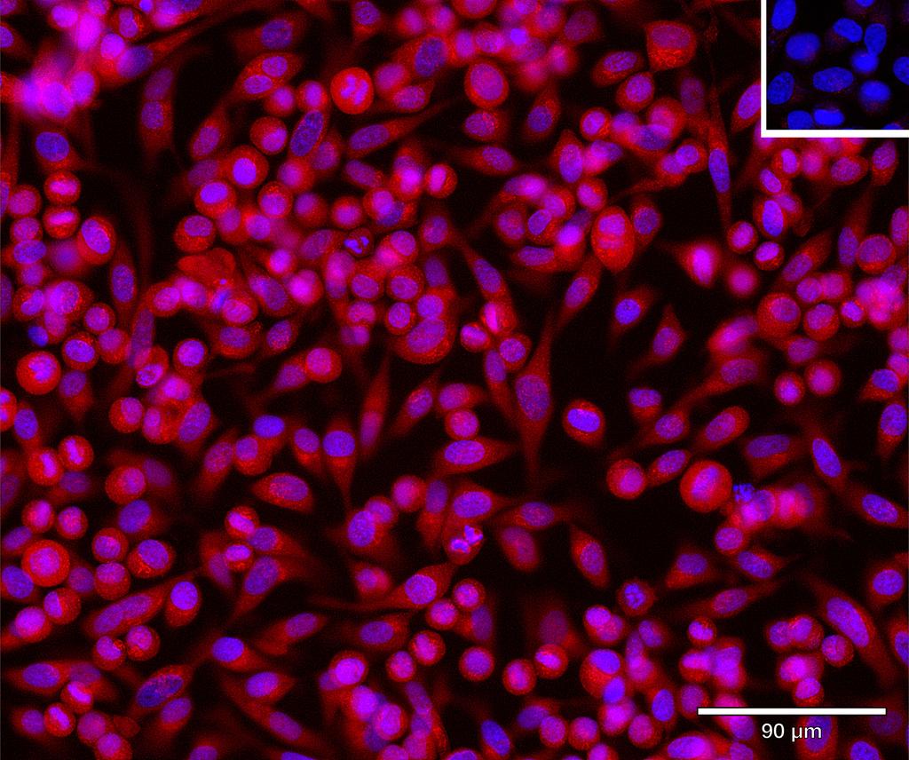 Ankyron MESD_HUMAN Clone AR40668