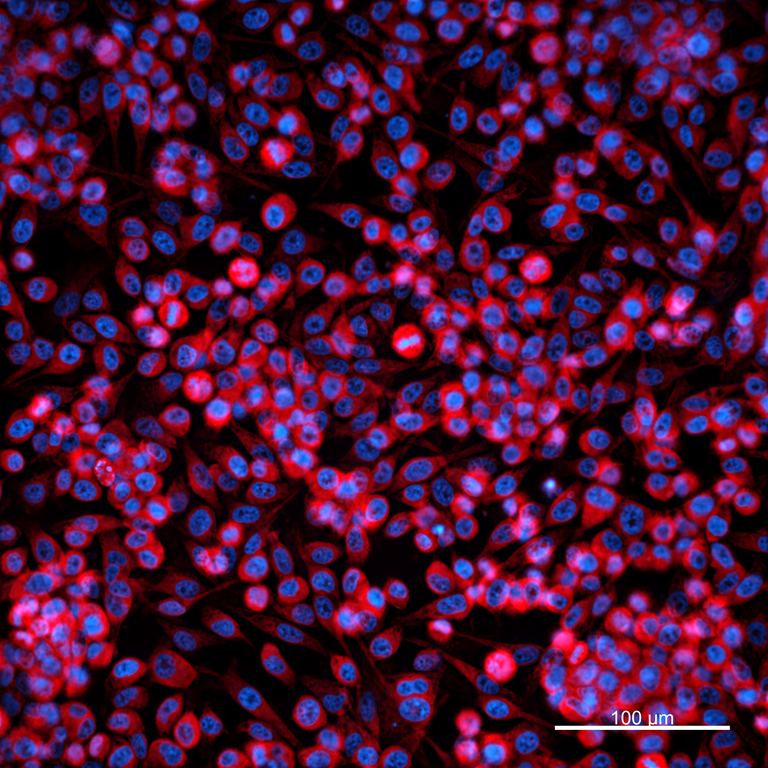 Ankyron MMP10_HUMAN Clone FK40241