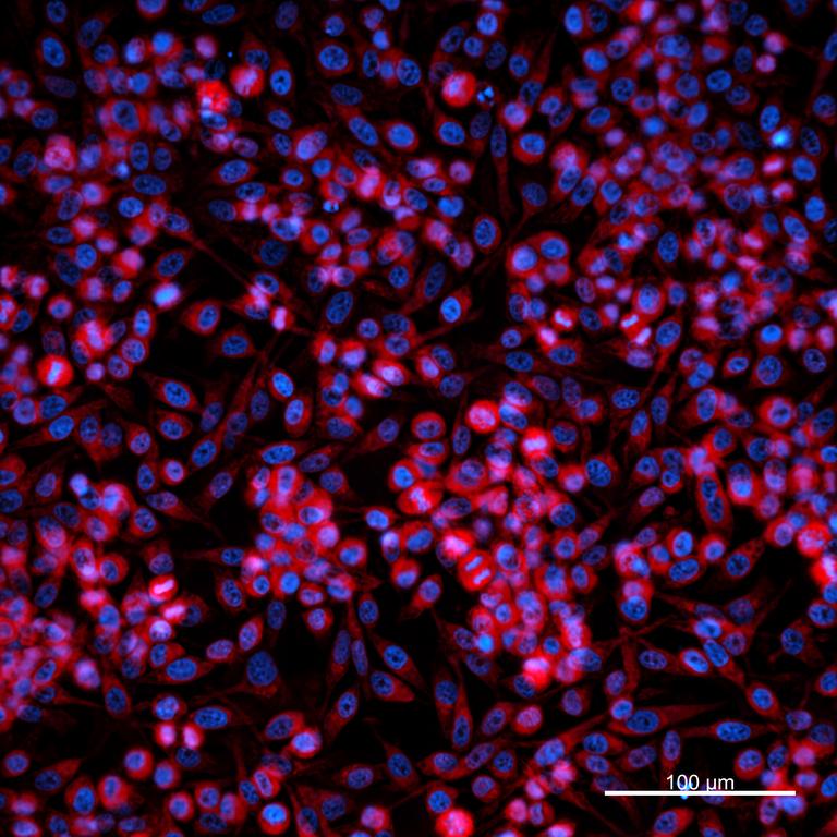 Ankyron MMP10_HUMAN Clone FK40243