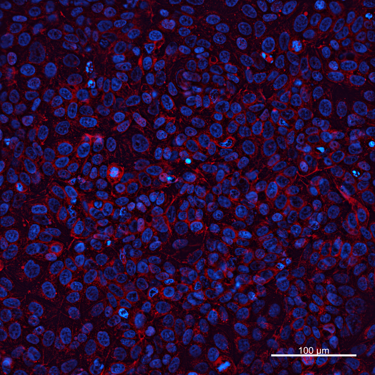 Ankyron MMP14_HUMAN Clone EM30564