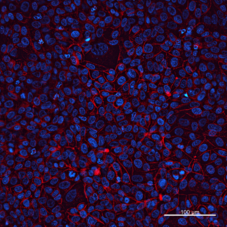 Ankyron MMP14_HUMAN Clone EO40205