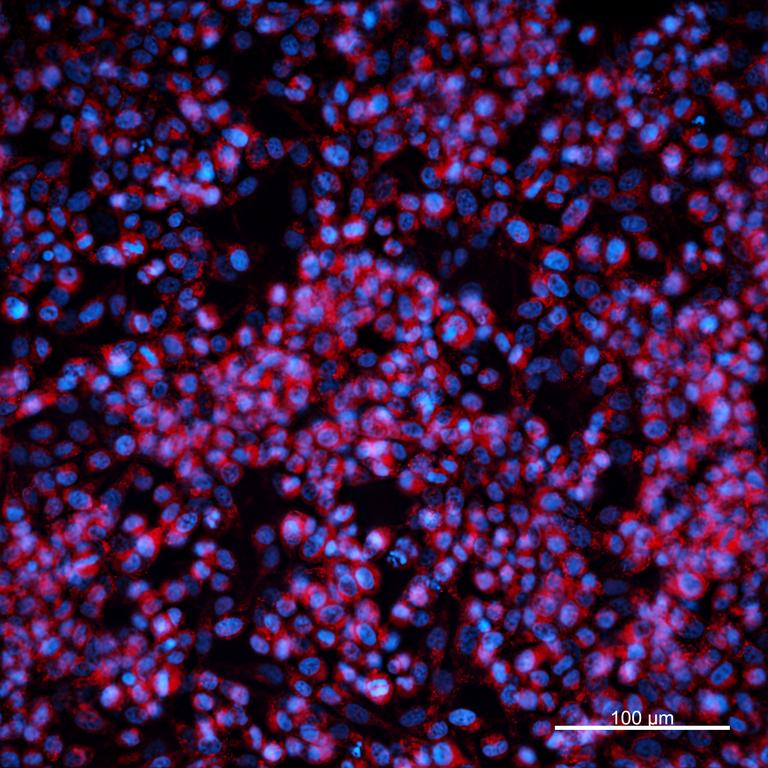 Ankyron MMP15_HUMAN Clone GE40878