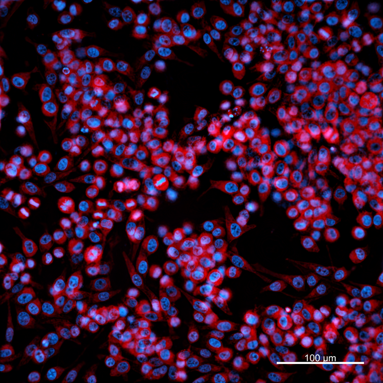 Ankyron MMP15_HUMAN Clone GE40866