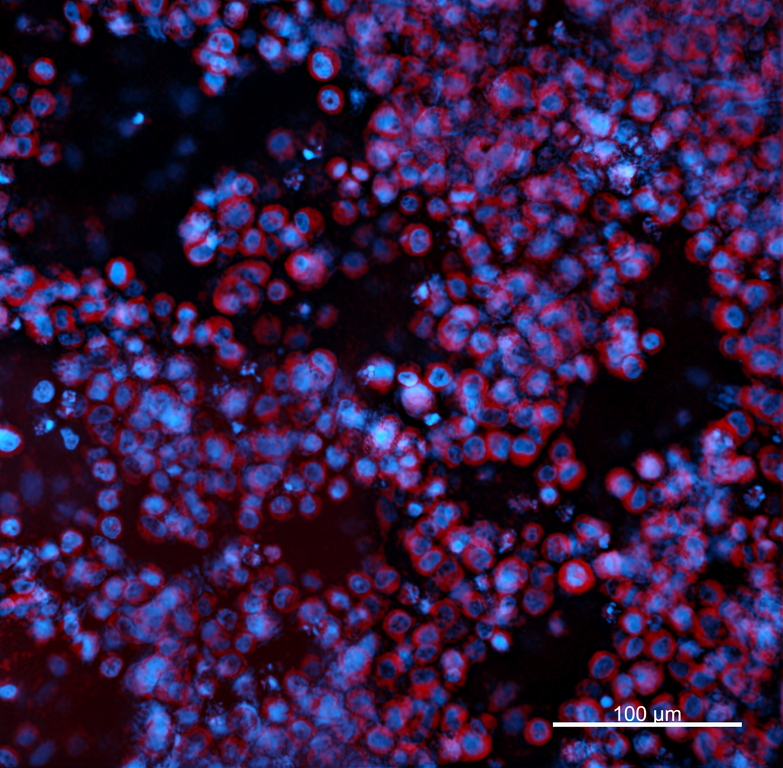 Ankyron MMP16_HUMAN Clone GE40887