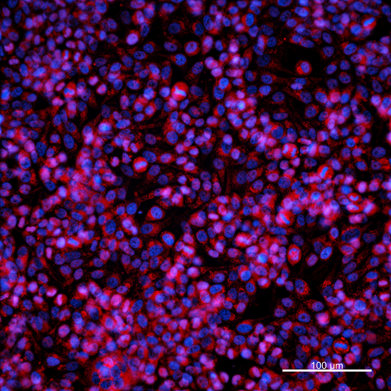 Ankyron MMP2_HUMAN Clone BC40125