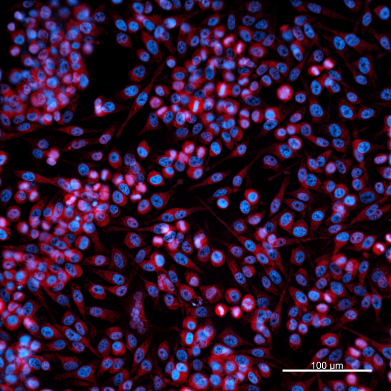 Ankyron MMP3_HUMAN Clone EC20127