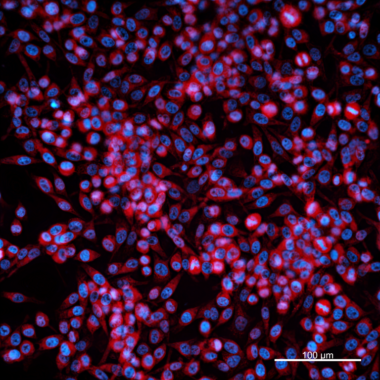 Ankyron MMP3_HUMAN Clone EC20135