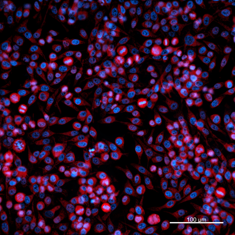 Ankyron MMP3_HUMAN Clone EC20130
