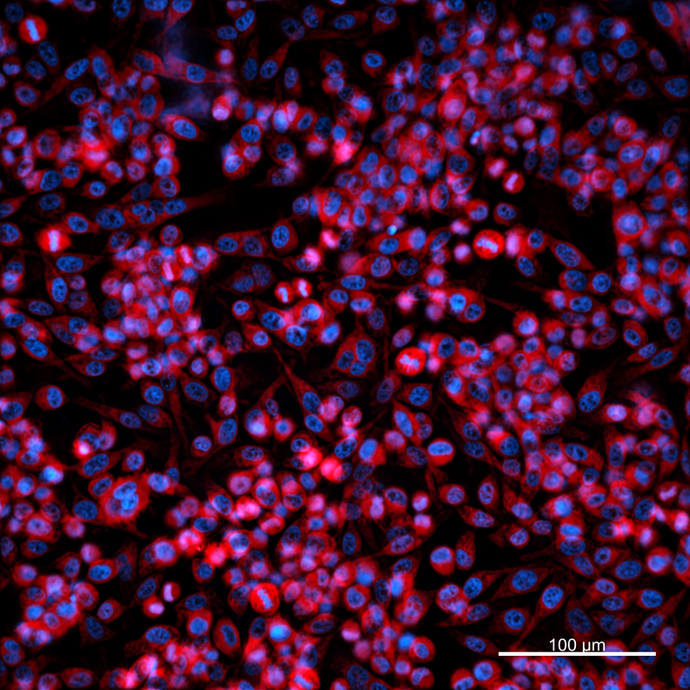 Ankyron MMP3_HUMAN Clone FI40334