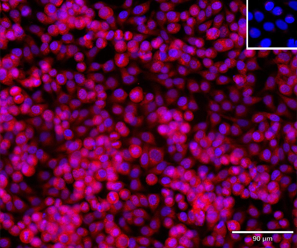 Ankyron MMP7_HUMAN Clone BS40728