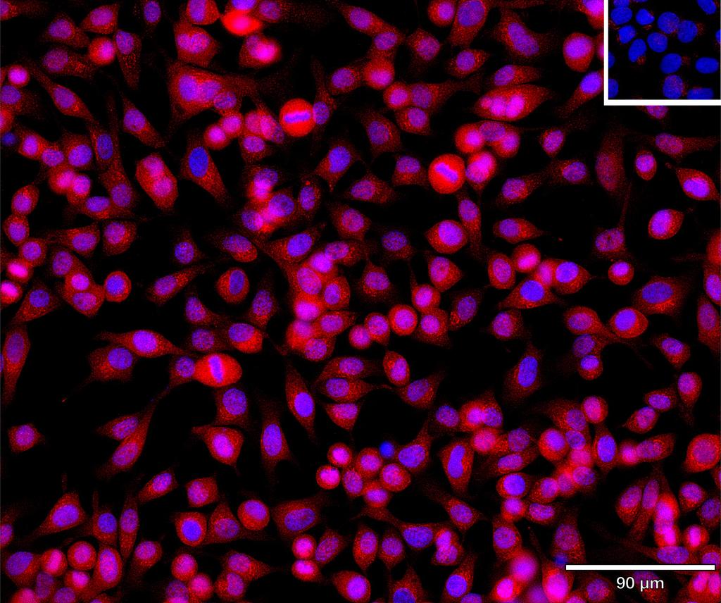 Ankyron MMP7_HUMAN Clone BS40747