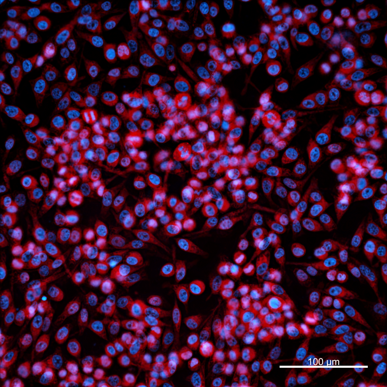 Ankyron MMP9_HUMAN Clone BJ40107
