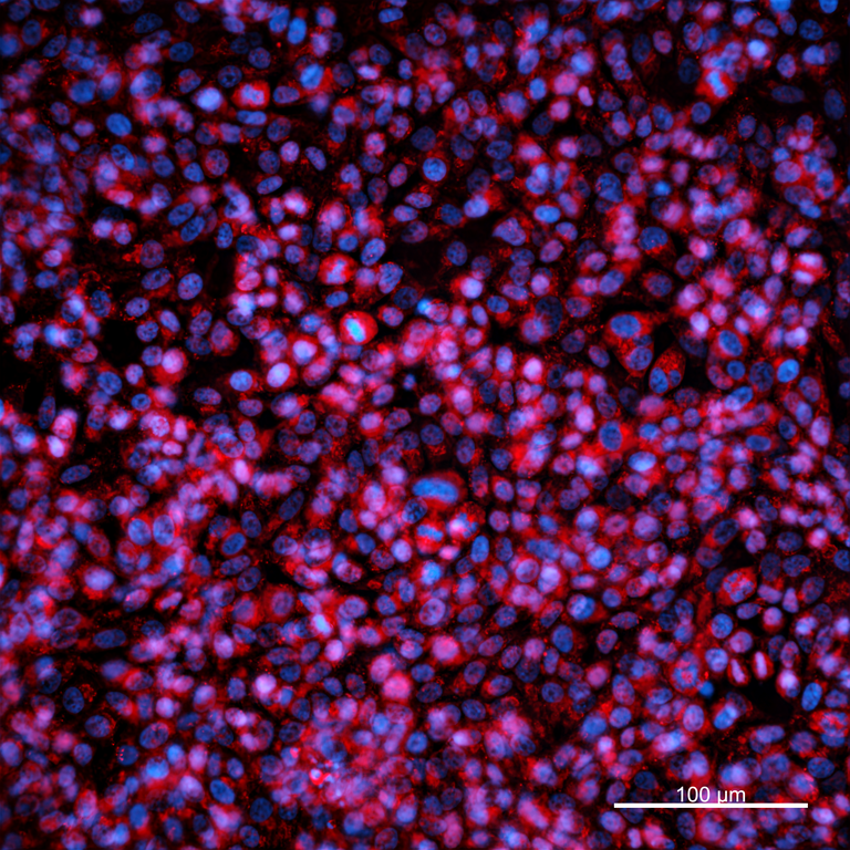 Ankyron MMP9_HUMAN Clone BJ40110