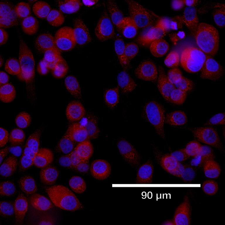Ankyron MMP9_HUMAN Clone BJ40111
