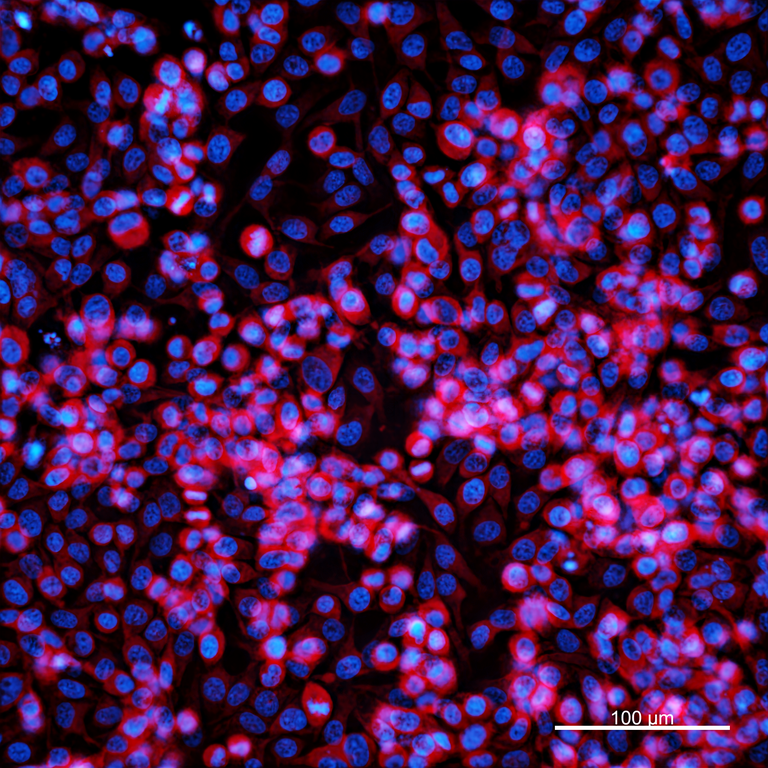 Ankyron MP2K2_HUMAN Clone DI40260