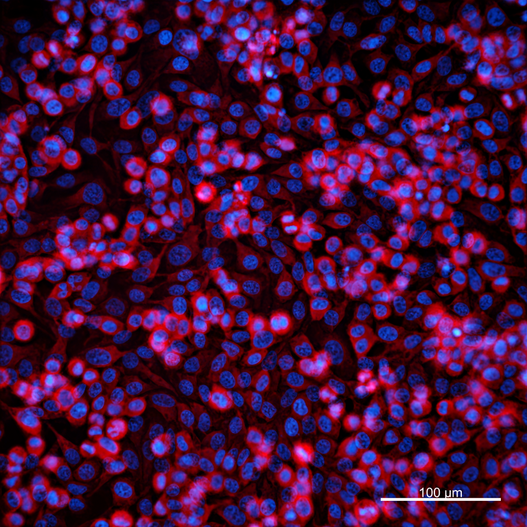 Ankyron MP2K2_HUMAN Clone DI40262