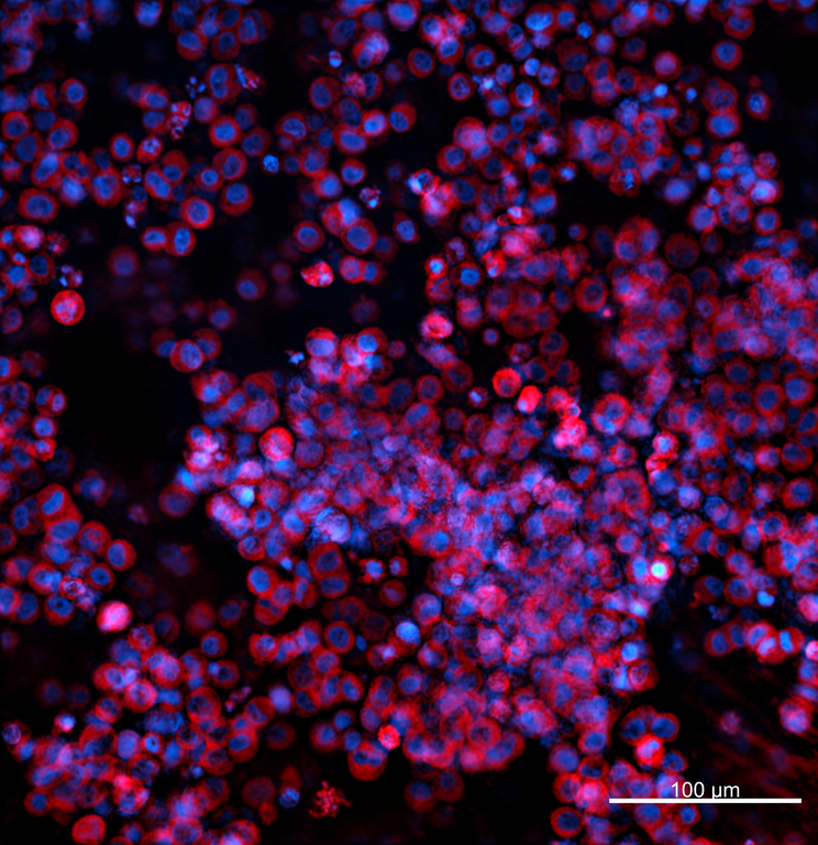 Ankyron MP2K5_HUMAN Clone EO40145