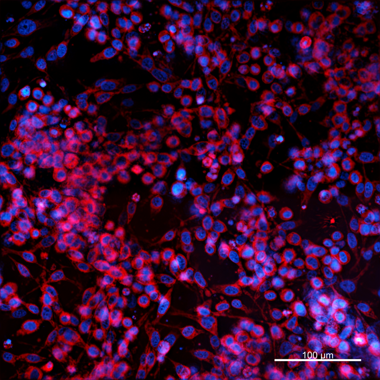 Ankyron MP2K5_HUMAN Clone EO40146
