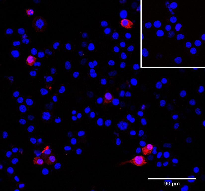 Ankyron MRC1_MOUSE Clone DK30107